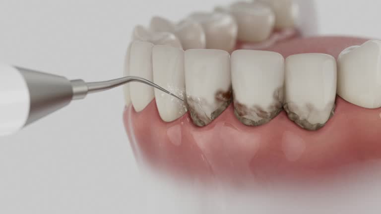 Trusted Dental Crowns And Bridges service in Rhome, TX - Dentist Open Now